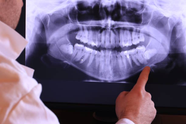 Best Emergency Dentist for Knocked-Out Tooth in Richmond Heights, FL