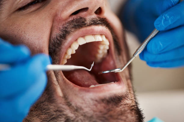 Best Mobile Emergency Dentist in Richmond Heights, FL