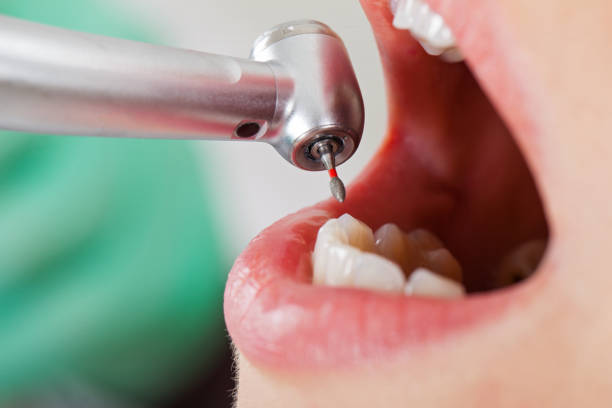 Best Urgent Dental Care for Toothache in Richmond Heights, FL